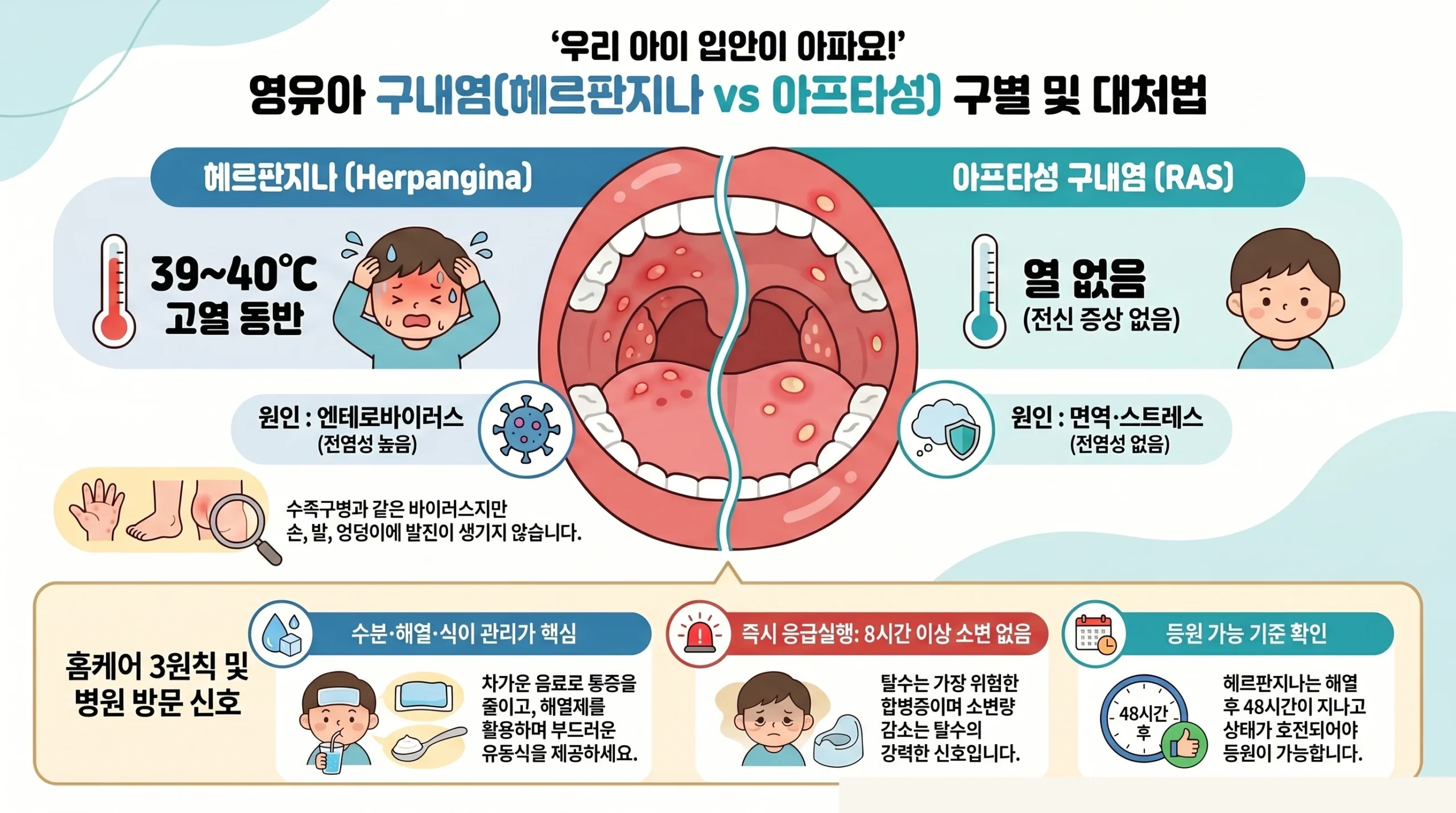영유아 구내염 봄철 완벽 가이드 — 헤르판지나·아프타성 증상·치료·등원 기준 종합 인포그래픽