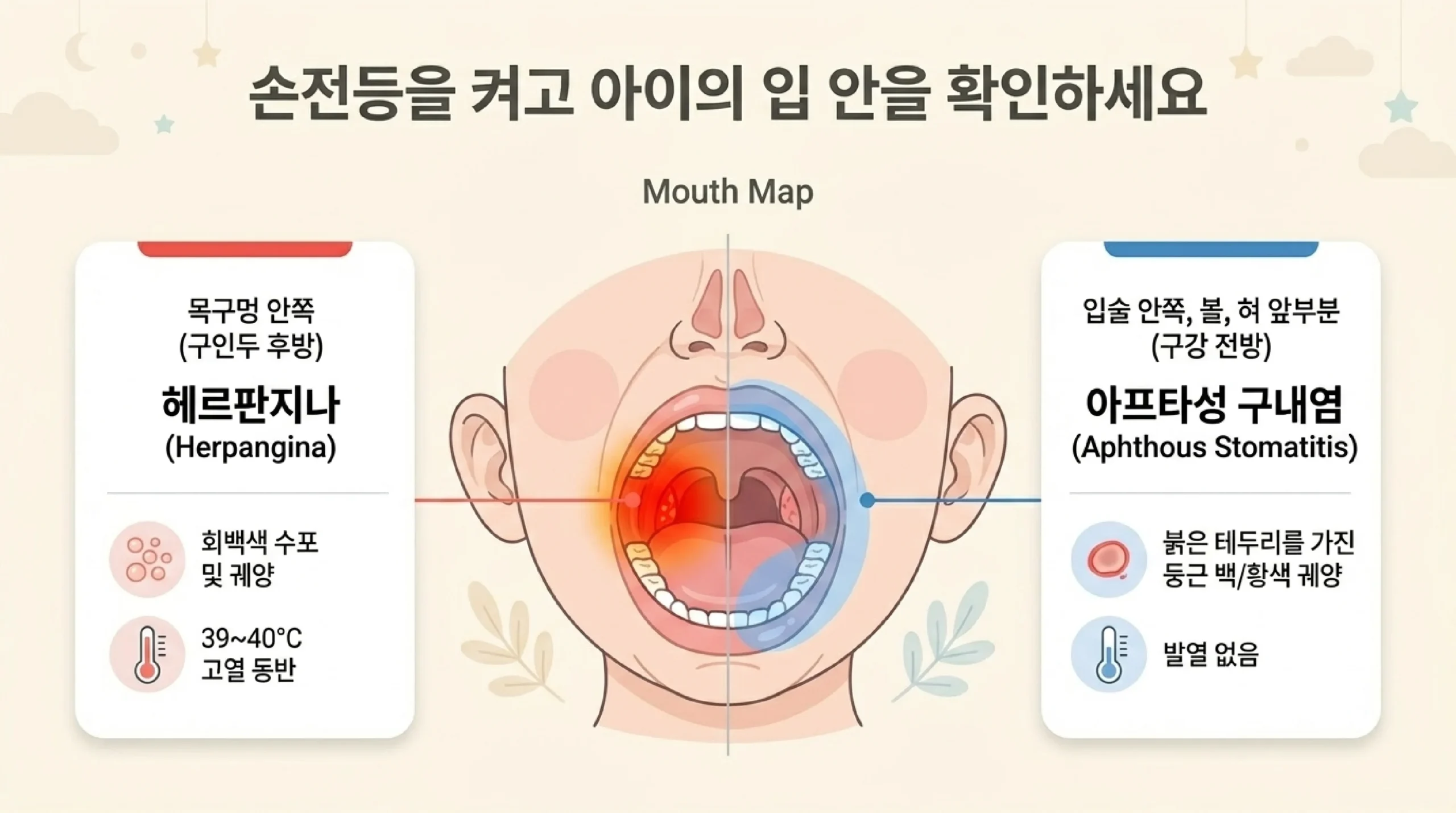 영유아 구내염 연령별 증상 — 0~12개월·1~2세·2~4세·4세 이상 비언어적 신호