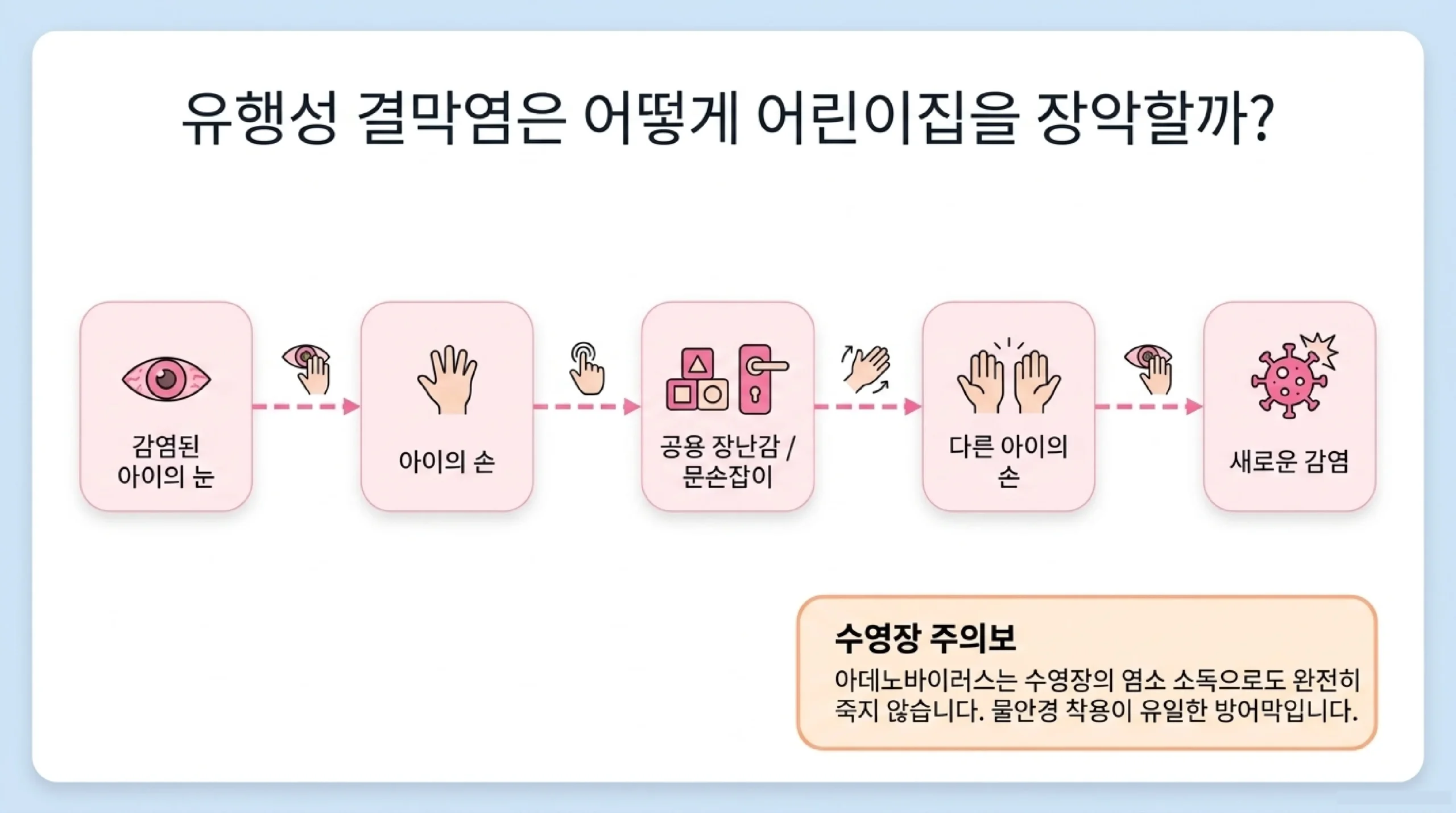 결막염 가정 돌봄 & 치료 원칙 — 바이러스성·알레르기성·세균성 유형별 대처법