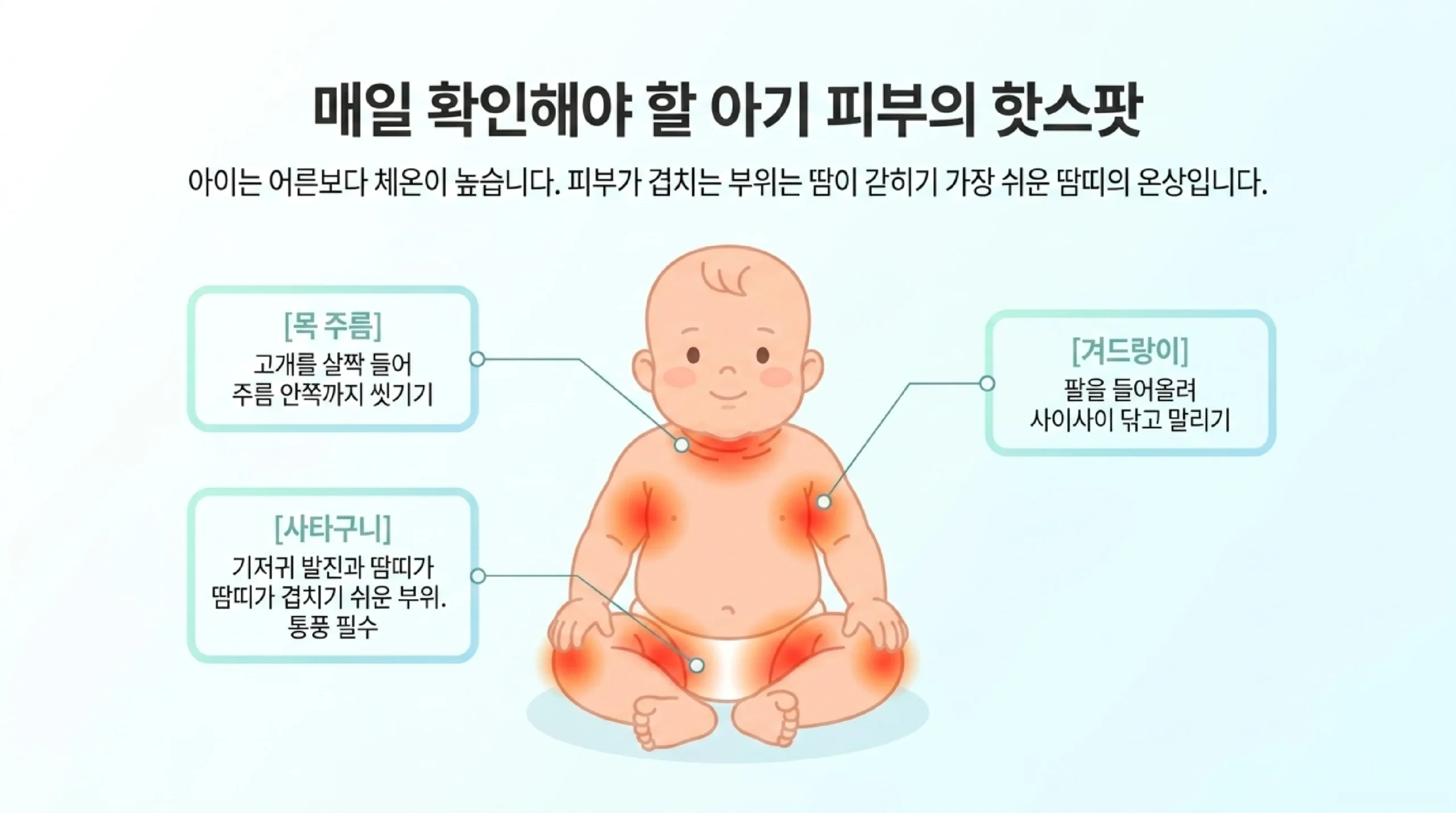 아이 땀띠 집에서 관리하는 법 — 목욕 횟수·냉찜질·옷소재·에어컨 온도