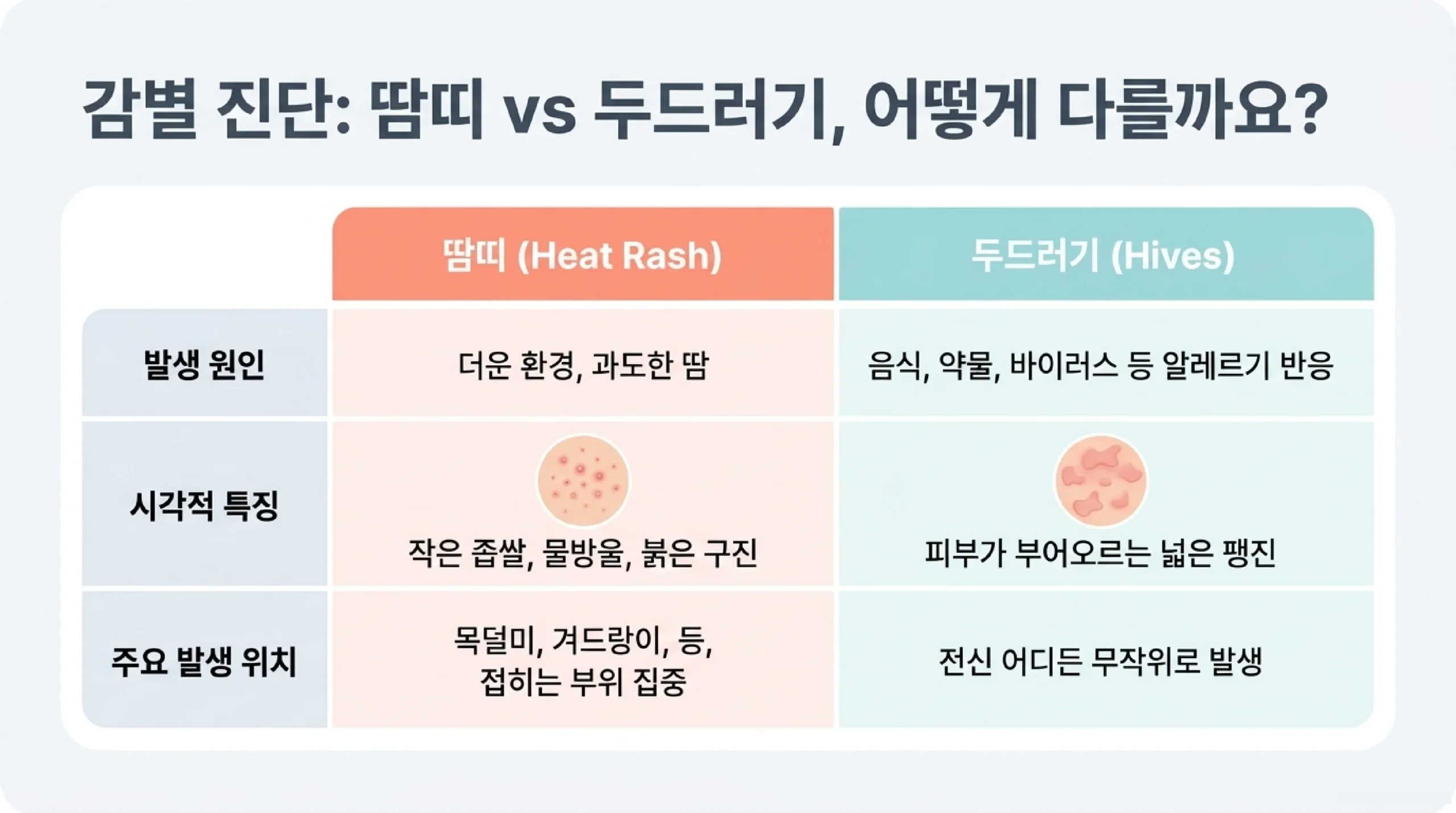 유아 땀띠 예방 체크리스트 10가지 — 여름철 피부 관리 루틴 총정리