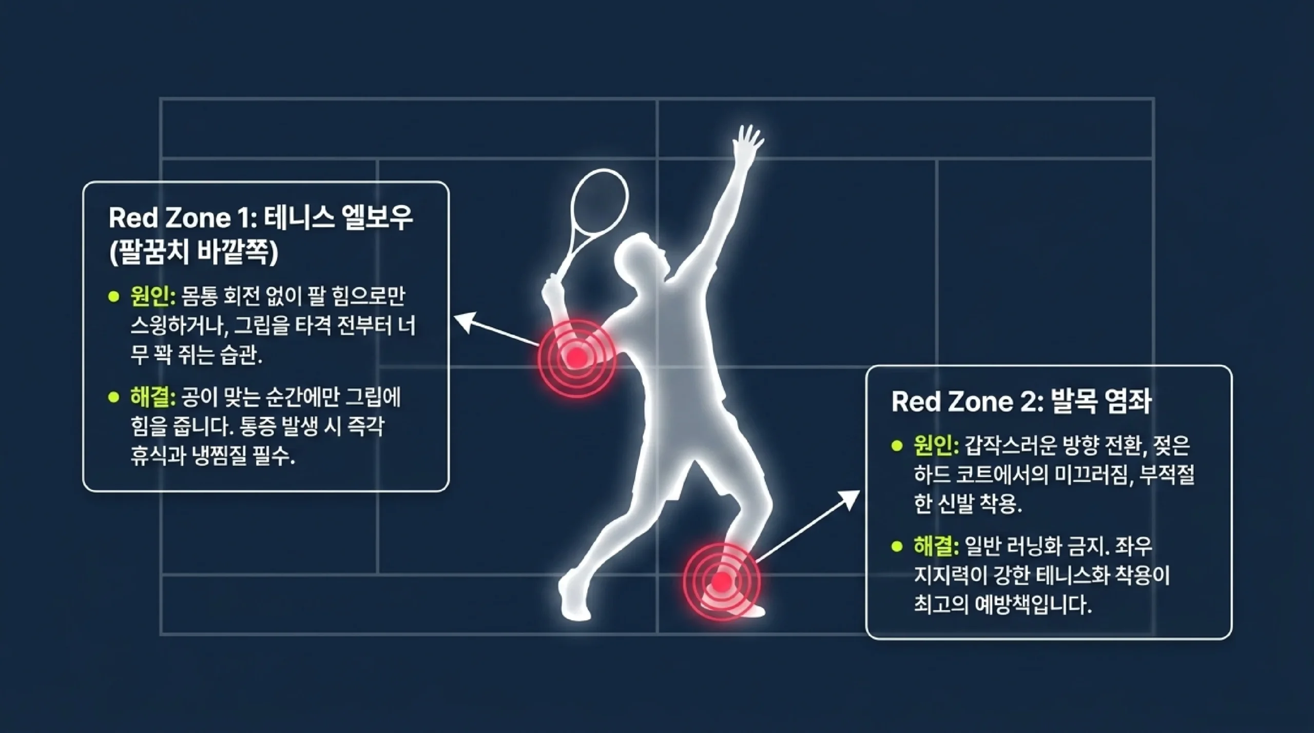 테니스 부상 예방 — 테니스 엘보우·발목 염좌 원인과 예방법